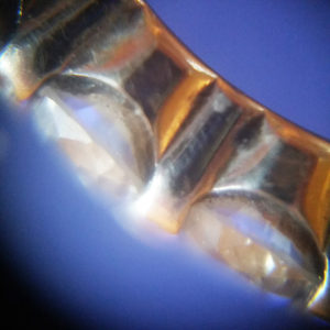 ring microscopy